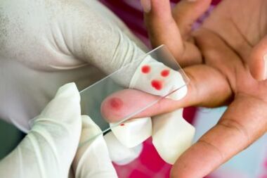 Diagnosis of finger joint pain