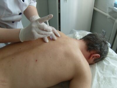 Intra-articular injections of chondroprotectants for thoracic osteochondrosis